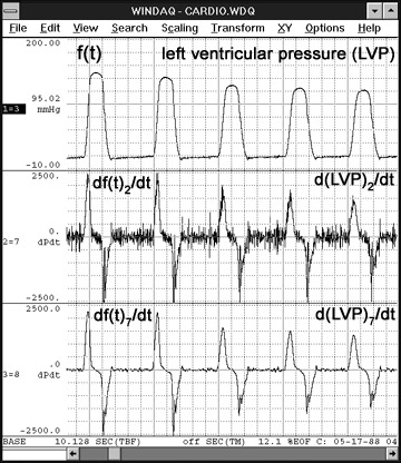 Data Acquisition Waveform - Differentiation Function on ventricular pressure waveform