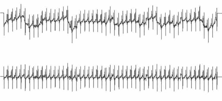 Data Acquisition Waveform - 97 point moving average filter applied