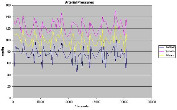 Data Acquisition Waveform - systolic, diastolic and mean data